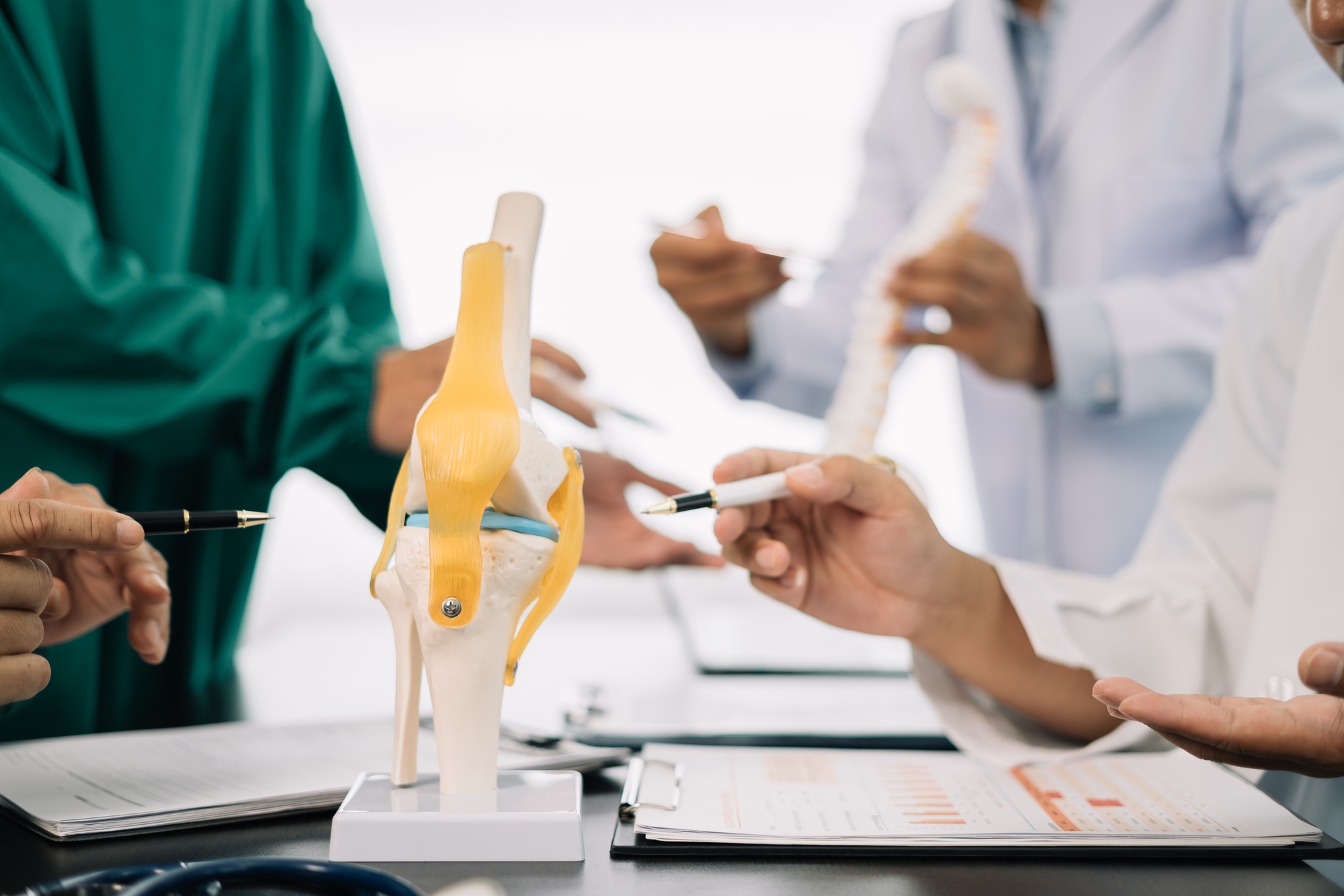 serious doctors team are analyzing fracture knee model showing